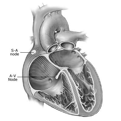 Critérios Diagnósticos das Taquicardias de QRS Estreito Taquicardias Supraventriculares Taquicardia Sinusal / TRS Taquicardia Atrial 1:1, 2:1, condução