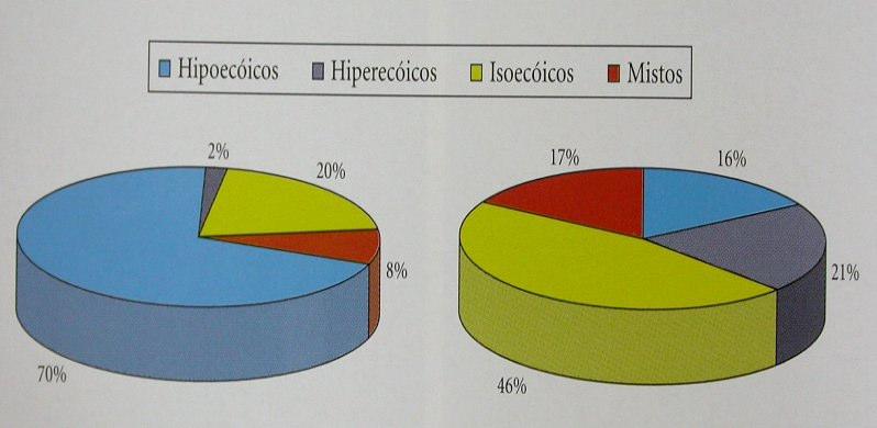 Diagnóstico do bócio nodular - US