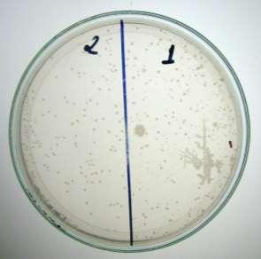Figura 2: Crescimento de colônias microbianas, antes e