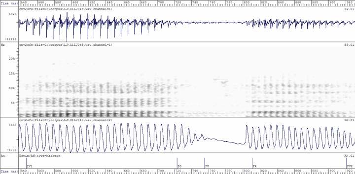 Análise Espectral [b] [d] [ɡ] Figura 47: Formas de onda e espectrogramas do sinal acústico e do sinal de