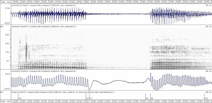 Análise Espectral [p] [t] [k]