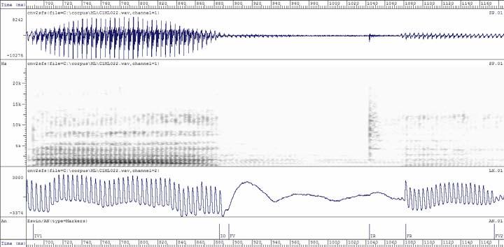 espectrogramas do sinal acústico e