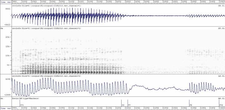 Análise Espectral [b] [d] [ɡ]