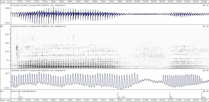 espectrogramas do sinal acústico e