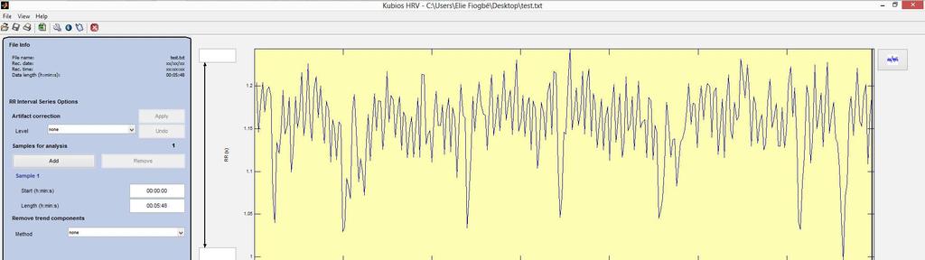 26 Modelo linear: domínio da frequência No domínio da frequência (DF), foi realizada a análise espectral pela Transformada Rápida de Fourier (FFT) utilizando o software Kubius HRV Analysis.