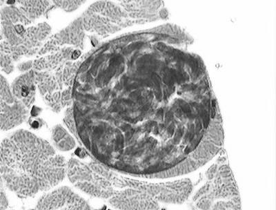 Bradizoítos (em cistos) INGESTÃO HOMEM EPITÉLIO INTESTINAL FELINO Penetração em diversos tipos de células formação de vacúolos citoplasmáticos FASE CRÔNICA DA DOENÇA Formação de CISTOS teciduais