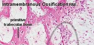 TECIDO CONJUNTIVO ÓSSEO Ocorrem dois métodos de formação óssea: Ossificação Intramembranosa: intra = dentro;