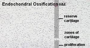 TECIDO CONJUNTIVO ÓSSEO Ocorrem dois métodos de formação óssea: Ossificação Endocondral: endo = dentro; condro = cartilagem