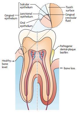 14 4 REVISÃO DE LITERATURA 4.1 CONSIDERAÇÕES PERIODONTAIS 4.1.1 Anatomia do periodonto O periodonto normal é constituído por tecidos de revestimento e de suporte do dente, são eles: gengiva, ligamento periodontal, cemento e osso alveolar.