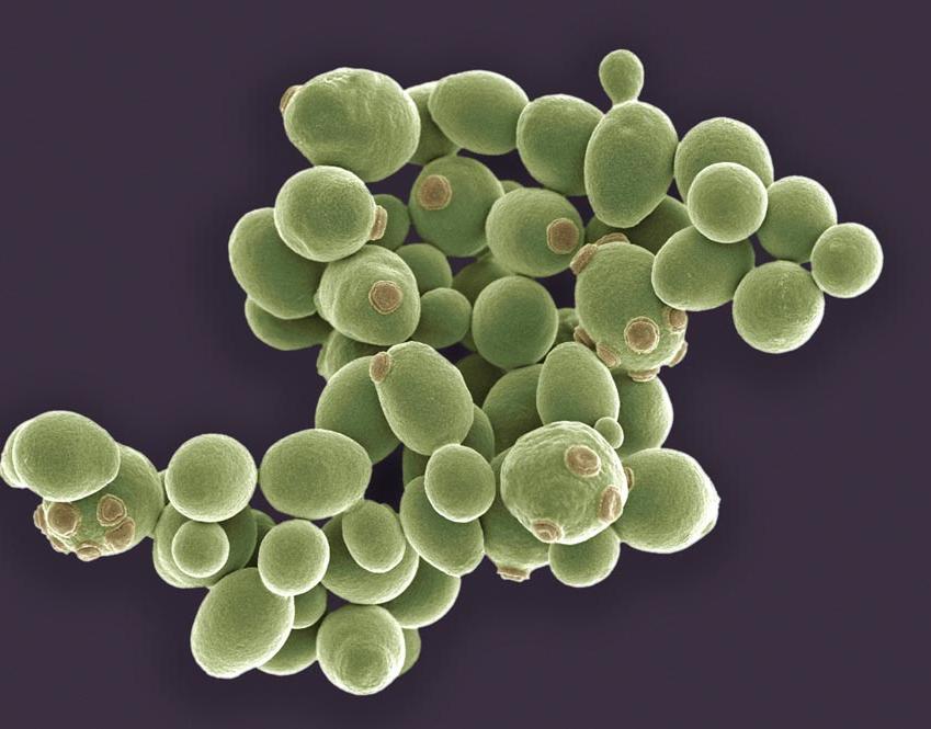 Glow Images/SCIENCE PHOTO LIBRARY/STEVE GSCHMEISSNER Fermentação Saccharomyces cerevisiae, fungo anaeróbio facultativo.
