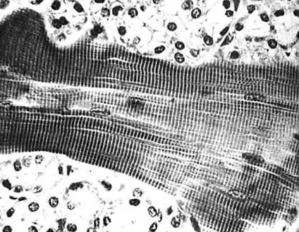 Exercício 1: (PUC-RIO 2009) A fotomicrografia apresentada é de um tecido que tem as seguintes características: controle voluntário, presença de células multinucleadas, condrioma desenvolvido, alto