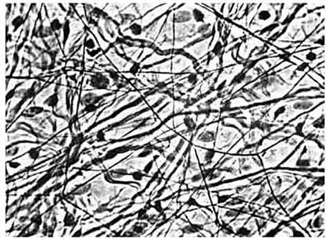 Exercício 2: (PUC-RIO 2009) A fotomicrografia apresentada a seguir é de um tecido que apresenta as seguintes características: riqueza de substância intercelular, tipos celulares variados e presença