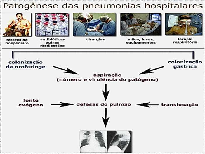 Cellis R 1988;Gross PA 1983;Leu HS 1989) PREVENÇÃO Pré-operatório: lavagem das mãos, minimizar