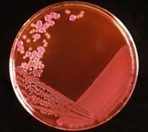 BACTÉRIAS Bactérias são procariontes Procariontes: organismos unicelulares e microscópicos que