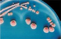 as colônias A maior bactéria conhecida foi descoberta em 1999 e se chama Pérola de Enxofre de