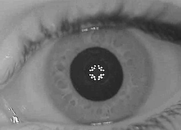 As características diâmicas da pupila selecioadas para aálise de comportameto padrão do olho são: + Circularidade; + Diâmetro; + Tempo para cotração/dilatação; + Taxa de cotração/dilatação; São