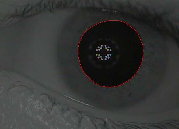 3.3. Circularidade Na figura 7 está destacado o cotoro da pupila para o cálculo da circularidade. A circularidade é uma característica diâmica da pupila.
