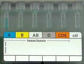 Anti-CDE Recomendável para Rh- Soro poliespecífico: Anti-D+Anti-E+Anti-C (mono ou policlonal) Finalidade: Identificar a presença dos Ag E e C em indivíduos RhD NEG (maioria E e C NEG) Importância: