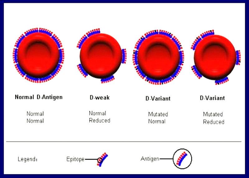 Número reduzido de antígenos RhD por hemácia sem aparente perda de epítopos Mutações de ponto missenses no gene (substituições de aa nas regiões transmembranares ou intracelulares da proteína) 30