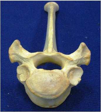 Exemplos: Escápula, ossos do crânio Fonte: Arquivo Pessoal Classificação Ossos Irregulares Não