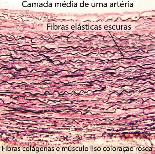 elástico; b) Tecido reticular; c)