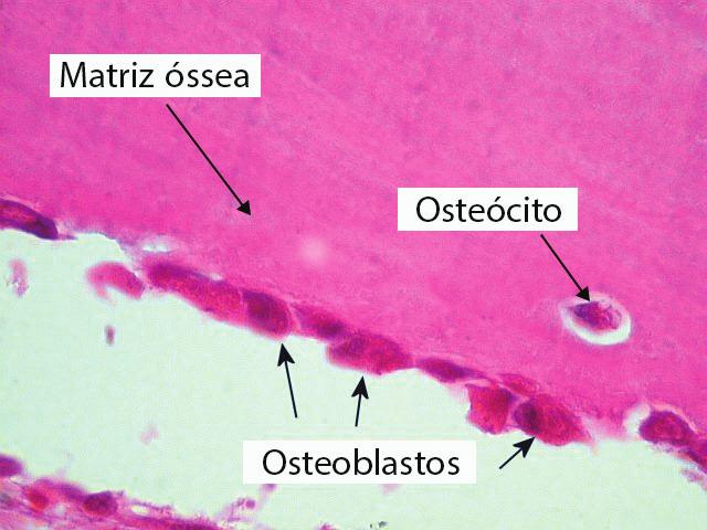 UNIDADE Tecidos Conjuntivos: Propriamente Dito, Elástico, Reticular, Mucoso, Adiposo e Ósseo a) Figura 5 Células do tecido ósseo: a) Osteoblastos e