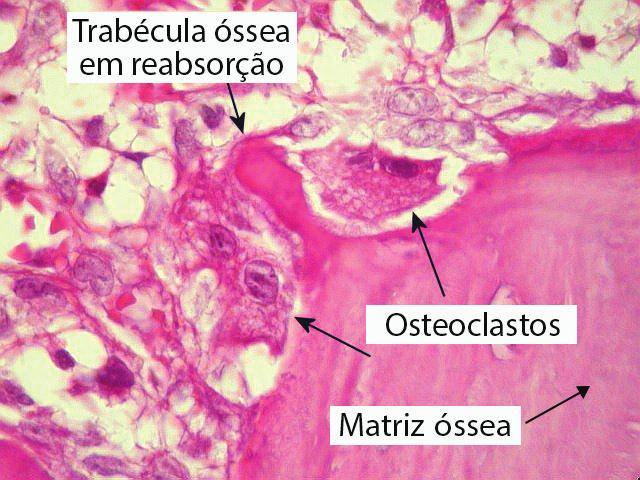 Antigamente, acreditava-se que os osteoclastos tinham origem a partir de uma junção de monócitos.