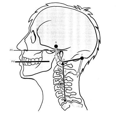 Olhos em posição horizontal Plano mastigatório e plano aurículo nasal se encontram em paralelos.