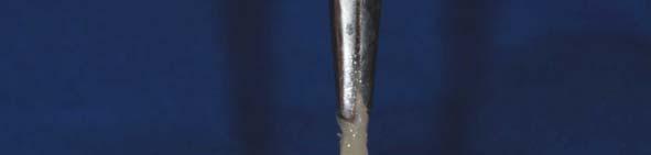 fibras de vidro emergindo do conduto, em torno do pino de fibras de vidro B) Utilização do porta-agulha para conformação das fitas em torno do