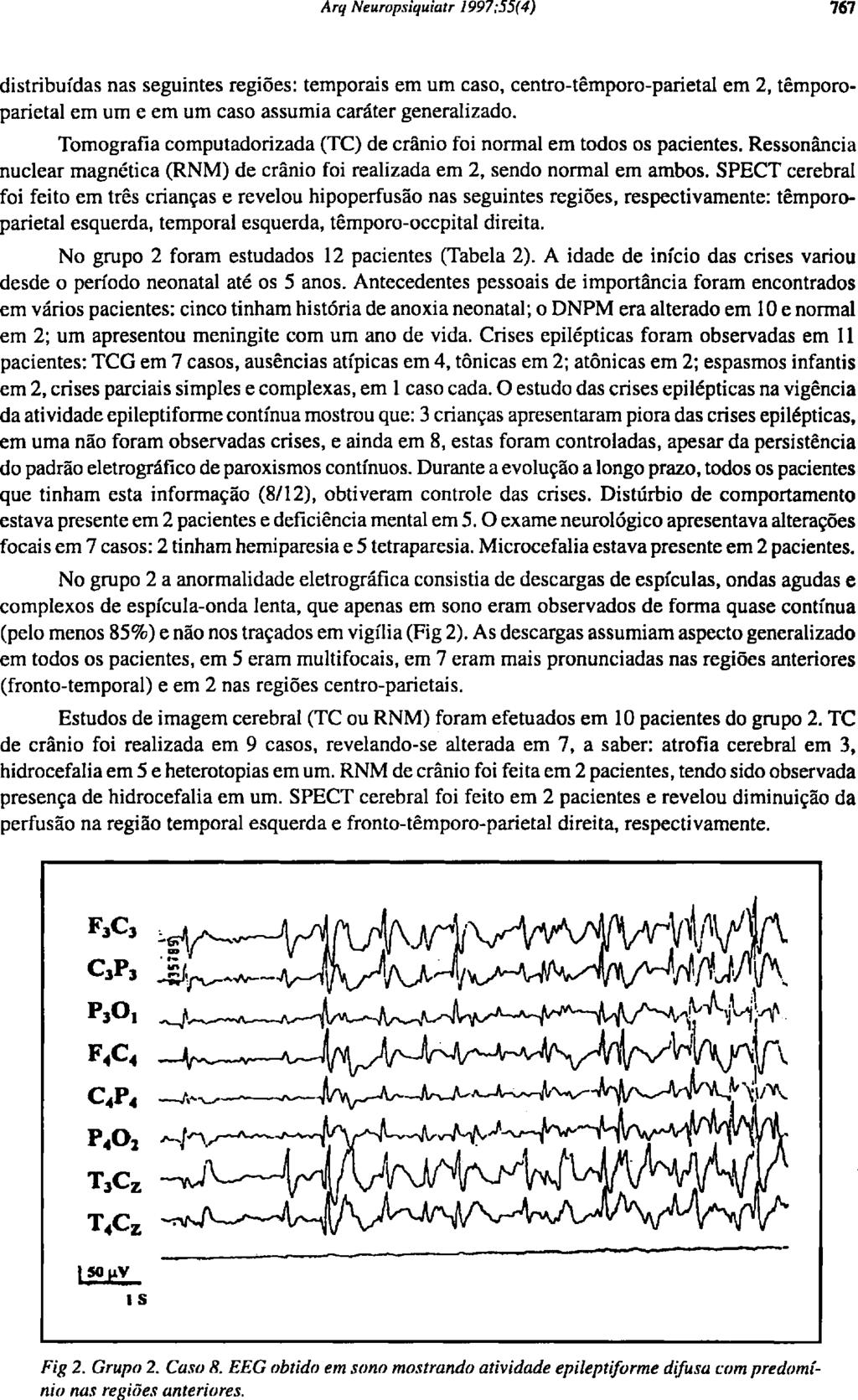 distribuídas nas seguintes regiões: temporais em um caso, ceníro-tèmporo-parielal em 2, temporoparietal em um e em um caso assumia caráter generalizado.