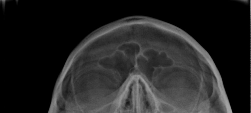 de Waters, submento-vértex ou Hirtz, lateral de crânio ou telerradiografia lateral, panorâmica, lateral oblíqua de mandíbula (corpo e ramo), radiografia póstero-anterior de