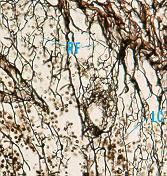 Tecido Conjuntivo Reticular Forma especializada de tecido conjuntivo frouxo Fibras reticulares associadas com fibroblastos especializados (células reticulares) Sustenta as células dos órgãos