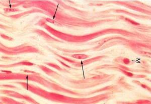 Fibroblasto Fibrócito Células adiposas Armazenamento de energia