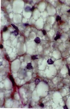 Células adiposas Unilocular Multilocular Formato globoso Mastócitos Núcleo esférico e central