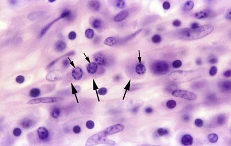 Plasmócitos Ovóides Núcleo esférico e excêntrico Citoplasma basófilo (RER)