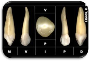 Ortodontia. Sendo um elemento chave para o estabelecimento da harmonia oclusal e compondo a guia anterior. (Filho, 2006) Figura 4 - Anatomia do canino maxilar. (adaptado de Filho, 2006) 6.