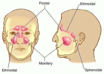 diminuir o peso do crânio. Frontal Etmoidal Etmoidal Maxilar Esfenoidal SEIOS DA FACE Ao circular pela cavidade nasal, o ar se purifica, umedece e aquece.