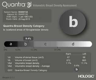 O software de análise de densidade da mama Quantra 2D e 3D.