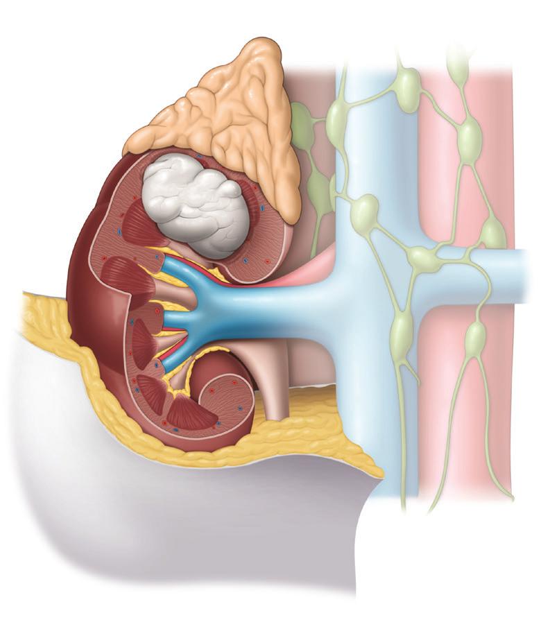 A biópsia renal não é procedimento padrão para o diagnóstico de cancro do rim.