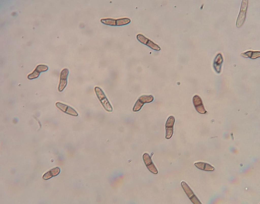 Doenças Causadas por Fungos do Gênero Stenocarpella spp. (=Diplodia spp.) em Milho 3 Identificação das Espécies Produção de Micotoxinas A identificação das podridões-brancas causadas por S.