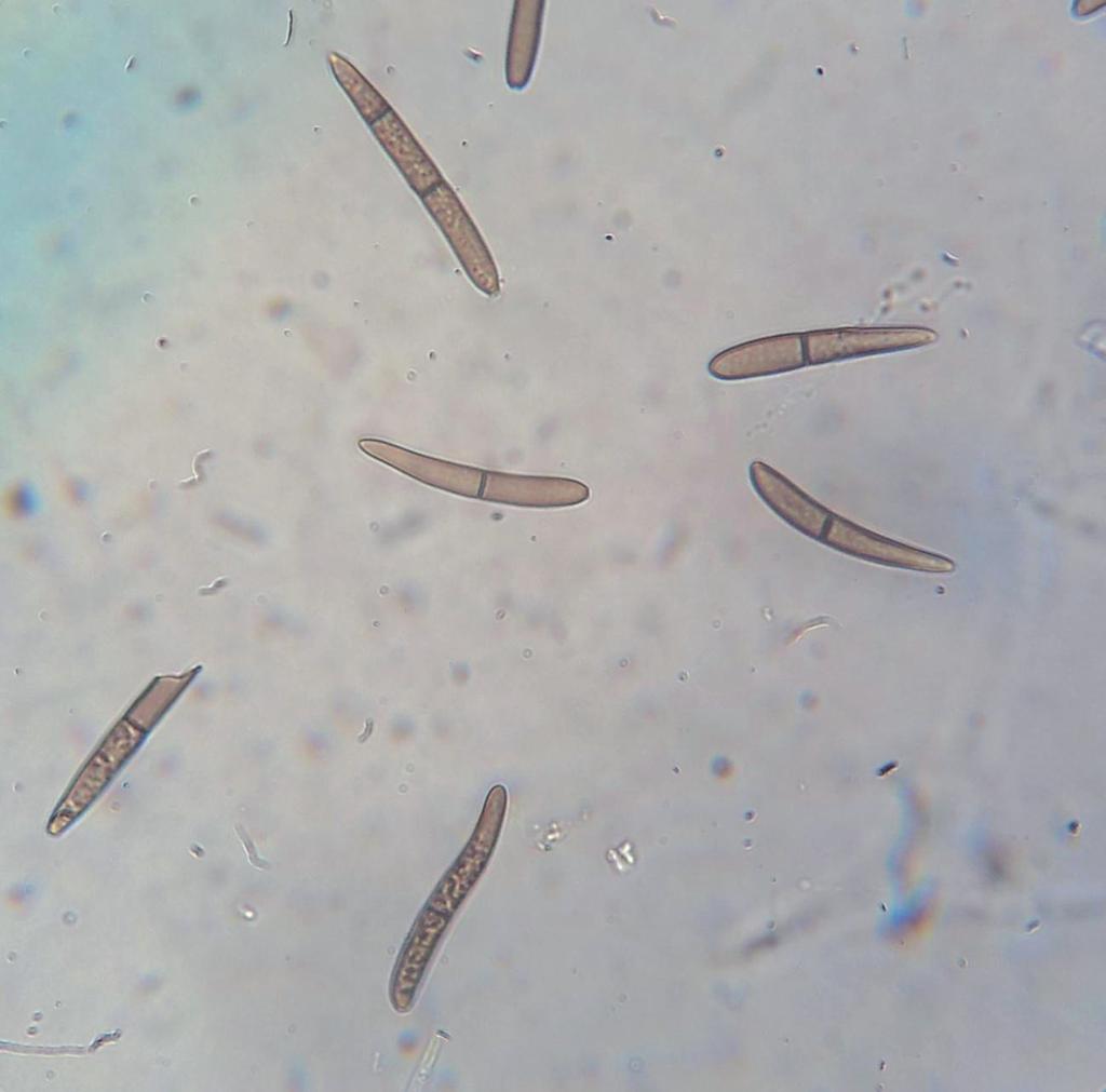 4 Doenças Causadas por Fungos do Gênero Stenocarpella spp. (=Diplodia spp.) em Milho micotoxinas produzidas por S.