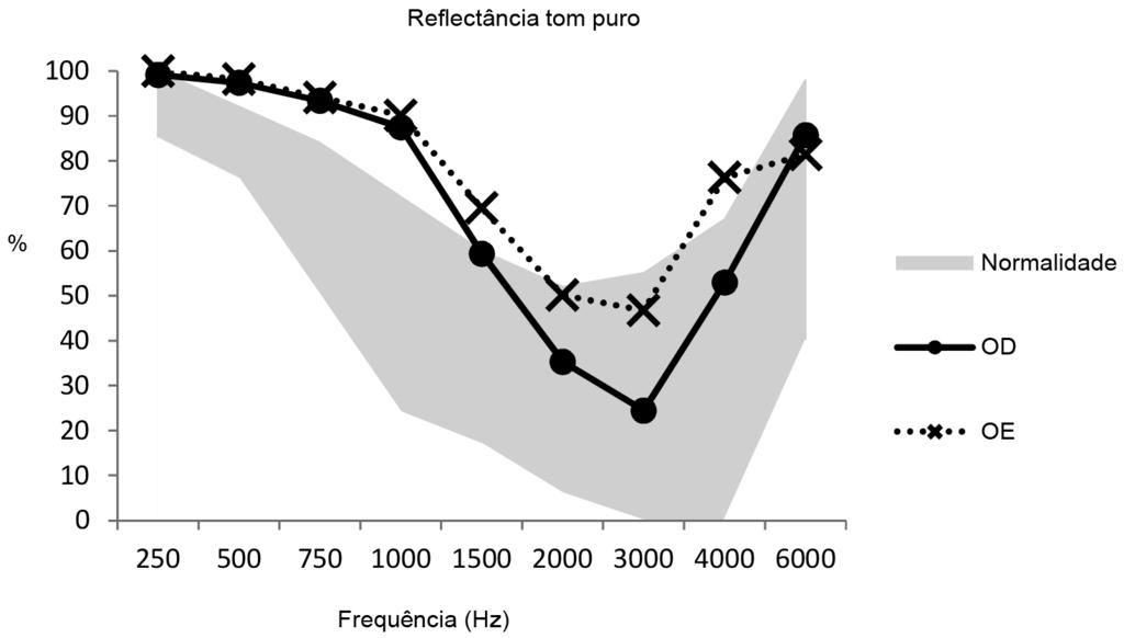 Cortez Neto L, Cibin BC, Carvallo RMM, Sanches SGG Comparando-se a taxa média de reflectância (250 a 6000 Hz) entre a orelha direita e a esquerda, houve diferença (p=0,021) Figura 2.