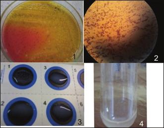 Avaliação Microbiológica de Maquiagens semeadas, pelo método de esgotamento em estrias, placas de ágar XLD- Xilose Lisina Desoxicolato (Merck ), incubadas de forma invertida, à temperatura de 30-35 C
