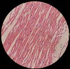 Lipofuscina Pigmento lipocromo nas células musculares e sincícios.
