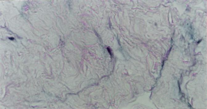 - Tecido mucoso G. da C. da Silva, T. de O. Plá & T. Montanari, UFRGS Figura 3.20 - Tecido mucoso do cordão umbilical, com células mesenquimais e substância fundamental em abundância. HE.