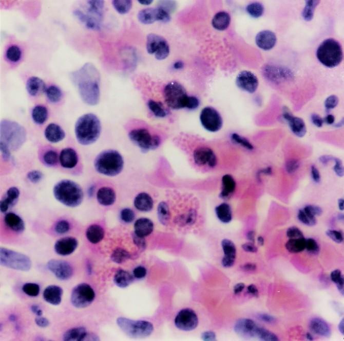 E Figura 3.35 - Nesse esfregaço de tecido mieloide, são observados eritroblastos ortocromáticos ( ), que formarão as hemácias (H), e metamielócitos eosinofílicos ( ), precursores dos eosinófilos (E).