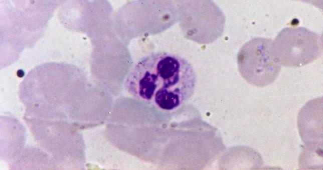 Os basófilos têm núcleo bilobulado ou retorcido, em S, grânulos azurófilos (lisossomos) e grânulos específicos basófilos, os quais se coram em azul-escuro e obscurecem o núcleo.