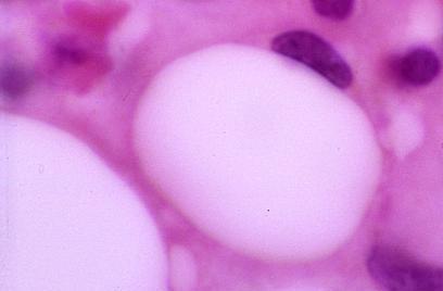 T. Montanari, UFRGS Figura 3.9 - Célula adiposa. HE. Objetiva de 100x. As células adiposas são células esféricas, muito grandes, que armazenam gordura.