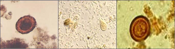 Figura 6: Da esquerda para a direita: Ovo infértil de A. lumbricoide, Trofozoítos e cistos de Giardia lamblia e Taenia spp a prevalência de parasitoses em crianças.