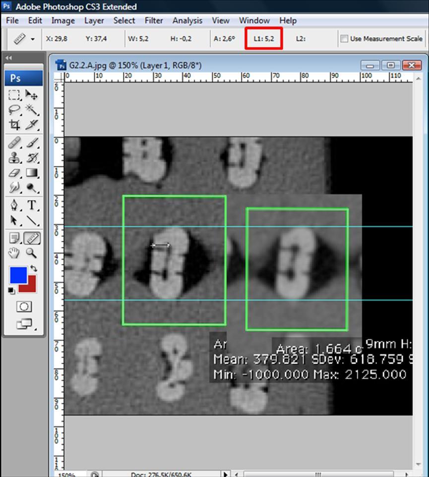 29 Figura 10. Imagens antes e após o preparo e medições realizadas com a ferramenta Ruler Tool do Adobe Photoshop.